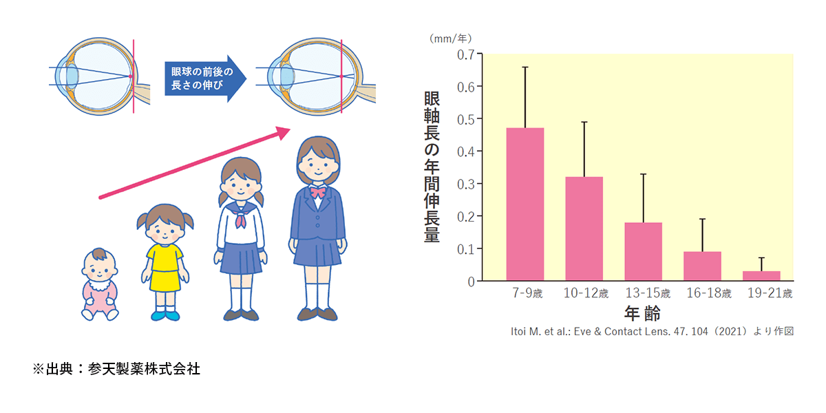 眼軸は低年齢でよく伸びます