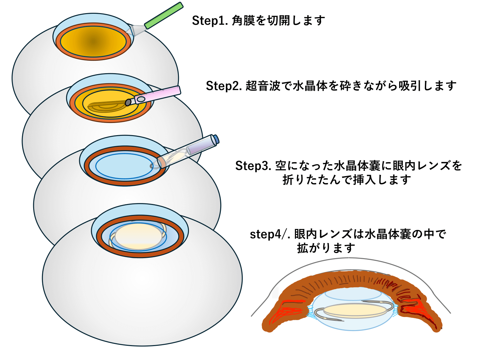 診療のご案内 | 【高松e眼科】Day Surgery 高松の眼科・硝子体