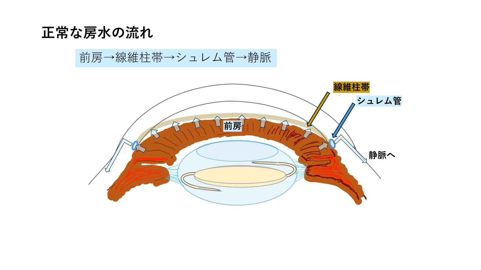日帰り白内障手術